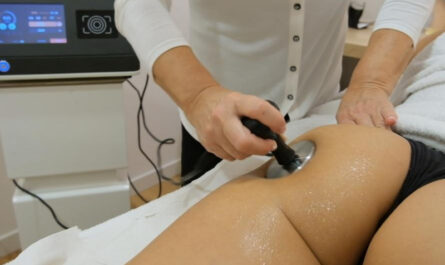 Radiofrecuencia